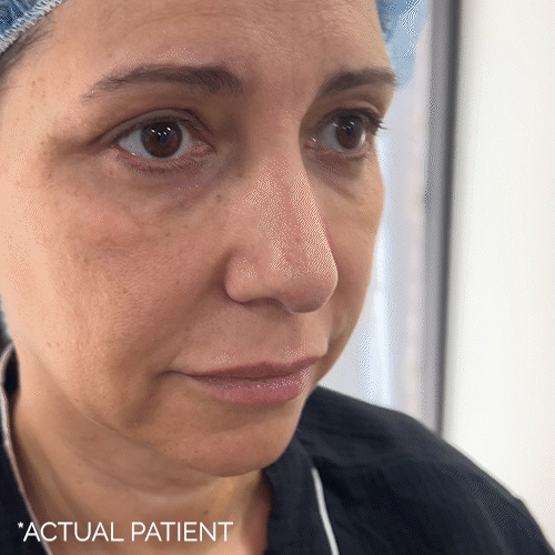 Aging Face before and after photos by Noses and Necks NYC in New York, NY