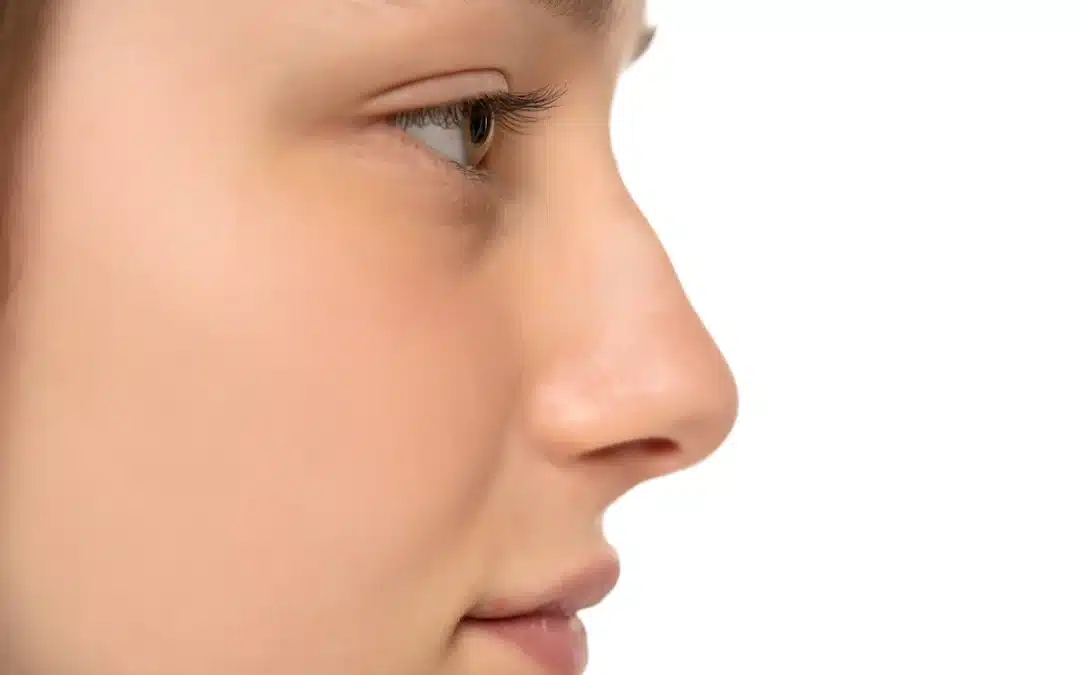 Nasal Septal Deviation in the Pediatric and Adult Populations