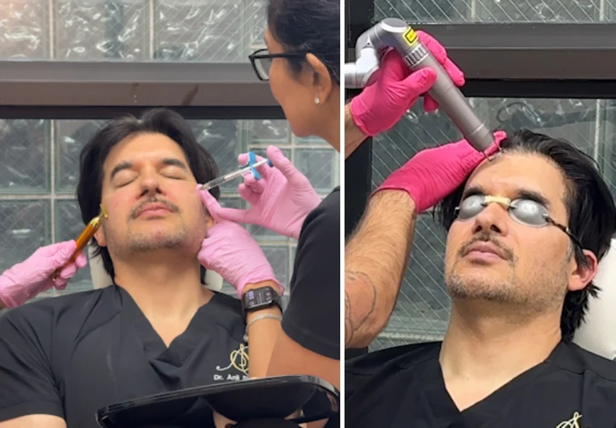 getting fillers and facial lasers