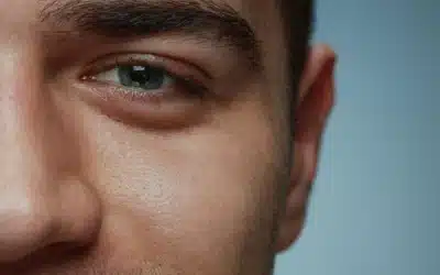 Why Do My Eyes Look Tired? Understanding Under-Eye Bags & Eyelid Aging