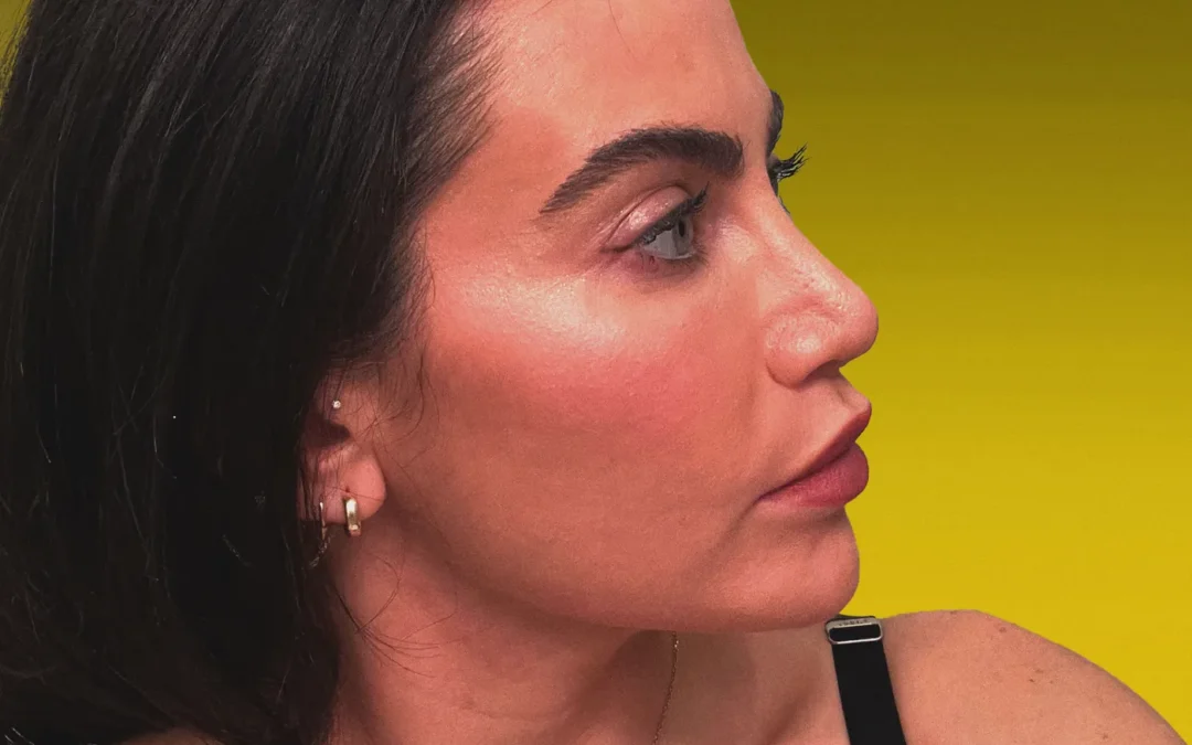 Why I Got a Nose Job in My Mid-30s