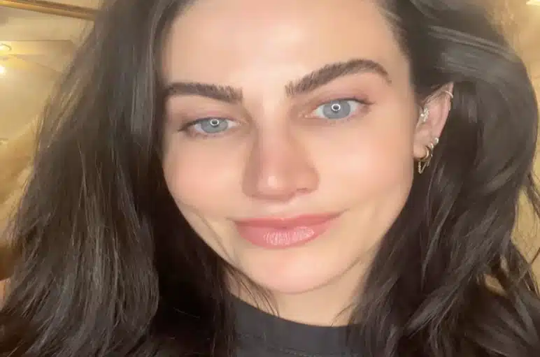 TikTok Influencer Patient 2 Weeks Post-Op Results