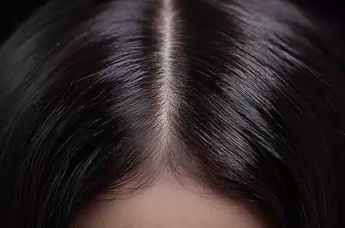 Treating Your Scalp’s ‘Micro-Zones’ May Be The Secret to Thicker, Healthier Hair